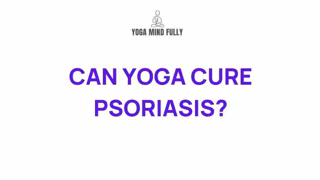 yoga-cure-psoriasis